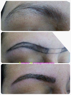 Foto Romano Micropigmentaci�n y Est�tica